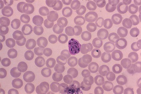 Detecting Malaria Cells